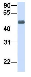 Anti-CHST2 antibody, Internal used in Western Blot (WB). GTX46441