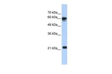 Anti-SEMA4F antibody, N-term used in Western Blot (WB). GTX46442