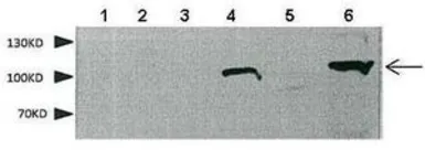Anti-SEMA4F antibody, N-term used in Western Blot (WB). GTX46442