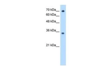 Anti-FCGRT antibody, N-term used in Western Blot (WB). GTX46447