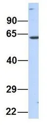 Anti-NT5DC2 antibody, N-term used in Western Blot (WB). GTX46459
