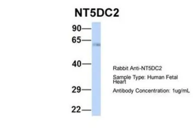 Anti-NT5DC2 antibody, N-term used in Western Blot (WB). GTX46459