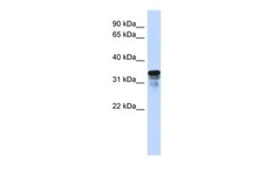 Anti-FAM82B antibody, N-term used in Western Blot (WB). GTX46469