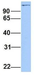Anti-NCAPD2 antibody, C-term used in Western Blot (WB). GTX46473