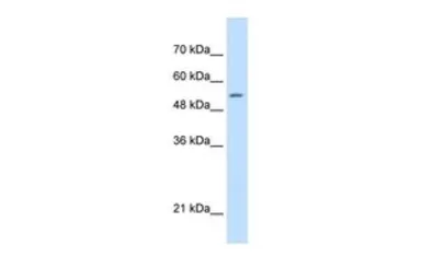 Anti-SHMT2 antibody, C-term used in Western Blot (WB). GTX46481