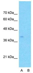 Anti-APOBEC3B antibody, N-term used in Western Blot (WB). GTX46485