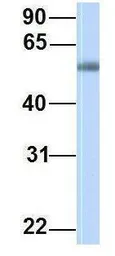 Anti-PPAT antibody, C-term used in Western Blot (WB). GTX46491