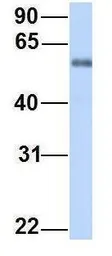 Anti-PPAT antibody, C-term used in Western Blot (WB). GTX46491