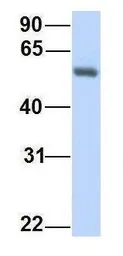 Anti-PPAT antibody, C-term used in Western Blot (WB). GTX46491