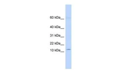 Anti-KRTAP8-1 antibody, Internal used in Western Blot (WB). GTX46506