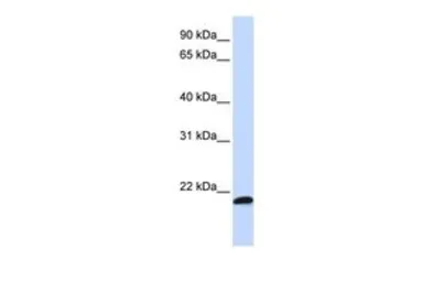 Anti-C21ORF56 antibody, Internal used in Western Blot (WB). GTX46513