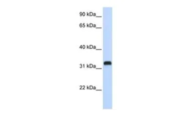 Anti-C21ORF62 antibody, Internal used in Western Blot (WB). GTX46515