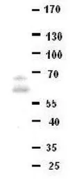 Anti-DONSON antibody, Internal used in Western Blot (WB). GTX46517