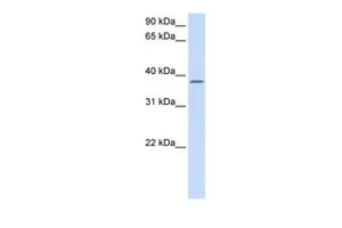Anti-C21ORF91 antibody, Internal used in Western Blot (WB). GTX46518