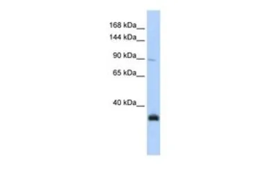 Anti-MORC3 antibody, N-term used in Western Blot (WB). GTX46520