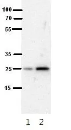 Anti-SH3BGR antibody, N-term used in Western Blot (WB). GTX46529