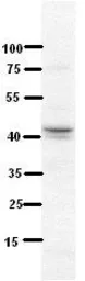 Anti-NDUFV3 antibody, Internal used in Western Blot (WB). GTX46530
