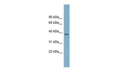 Anti-SDSL antibody, N-term used in Western Blot (WB). GTX46534