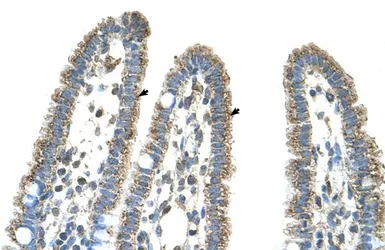 Anti-CPS1 antibody, Internal used in IHC (Paraffin sections) (IHC-P). GTX46535