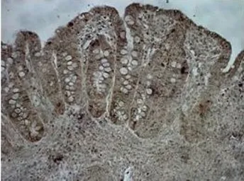 Anti-CPS1 antibody, Internal used in IHC (Paraffin sections) (IHC-P). GTX46535