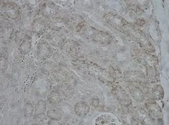 Anti-CPS1 antibody, Internal used in IHC (Paraffin sections) (IHC-P). GTX46535