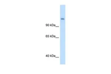 Anti-CPS1 antibody, Internal used in Western Blot (WB). GTX46535