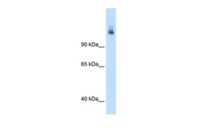 Anti-CPS1 antibody, N-term used in Western Blot (WB). GTX46536