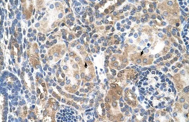 Anti-Mineralocorticoid Receptor antibody, Internal used in IHC (Paraffin sections) (IHC-P). GTX46537
