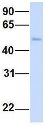 Anti-CHST1 antibody, Internal used in Western Blot (WB). GTX46545