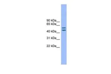 Anti-TM7SF2 antibody, N-term used in Western Blot (WB). GTX46551