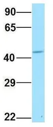 Anti-TM7SF2 antibody, N-term used in Western Blot (WB). GTX46551