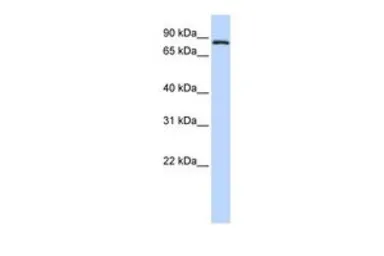 Anti-TFR2 antibody, Internal used in Western Blot (WB). GTX46552