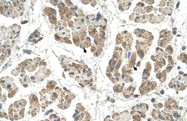 Anti-SSR2 antibody, N-term used in IHC (Paraffin sections) (IHC-P). GTX46554