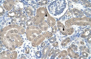 Anti-TRAP alpha antibody, N-term used in IHC (Paraffin sections) (IHC-P). GTX46556