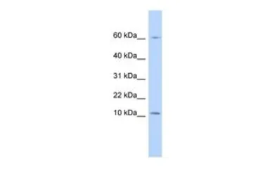 Anti-Elafin antibody, N-term used in Western Blot (WB). GTX46561