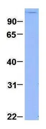 Anti-PCDHGC3 antibody, C-term used in Western Blot (WB). GTX46562