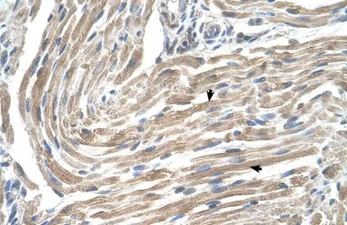 Anti-MGST2 antibody, N-term used in IHC (Paraffin sections) (IHC-P). GTX46564