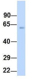 Anti-FMO4 antibody, N-term used in Western Blot (WB). GTX46568