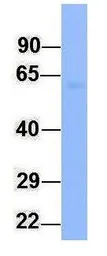 Anti-FMO4 antibody, N-term used in Western Blot (WB). GTX46568