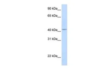Anti-COX10 antibody, Internal used in Western Blot (WB). GTX46576