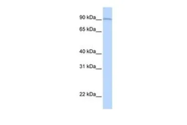 Anti-AOC2 antibody, Internal used in Western Blot (WB). GTX46578