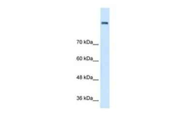 Anti-AOC2 antibody, Internal used in Western Blot (WB). GTX46579