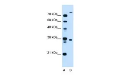 Anti-FLJ22167 antibody, N-term used in Western Blot (WB). GTX46584