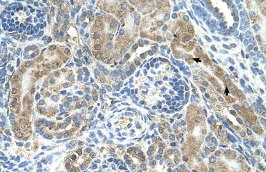 Anti-CRELD1 antibody, C-term used in IHC (Paraffin sections) (IHC-P). GTX46585