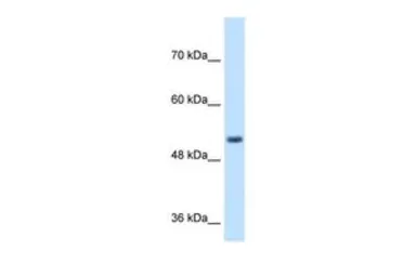 Anti-SPPL2B antibody, N-term used in Western Blot (WB). GTX46586