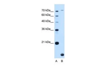 Anti-TMEM91 antibody, N-term used in Western Blot (WB). GTX46591