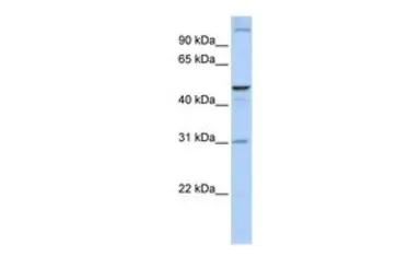 Anti-ACBD5 antibody, N-term used in Western Blot (WB). GTX46593