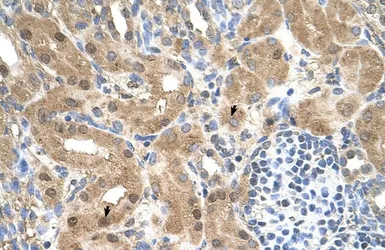Anti-MGC39633 antibody, N-term used in IHC (Paraffin sections) (IHC-P). GTX46594