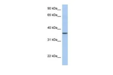 Anti-LFNG antibody, N-term used in Western Blot (WB). GTX46596
