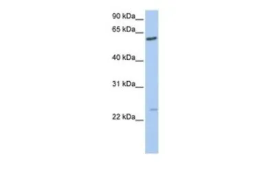 Anti-FAM3C antibody, C-term used in Western Blot (WB). GTX46599